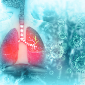 דלקת ריאות – מומחה ריאות פרטי - קשת רפואה