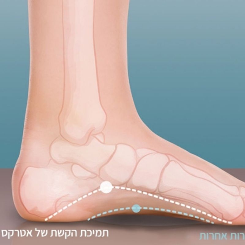 מדרסים אורתופדיים מבשרת ציון