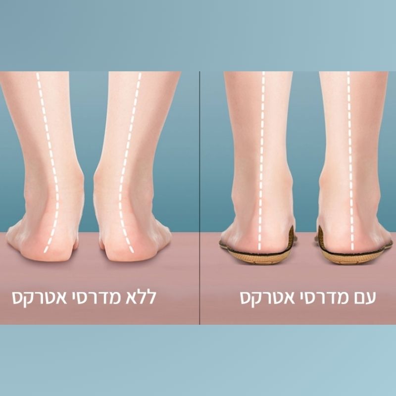 מדרסים מותאמים אישית לפי מבנה הרגל וסגנון ההליכה