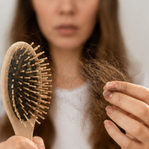 נשירת שיער מוגברת